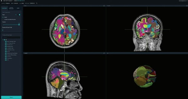 AI 의료기기 ‘뷰노메드 딥브레인’ FDA 인증 획득…“미국시장 공략 초석”